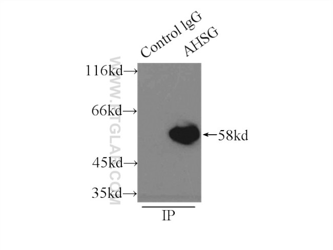 Fetuin-A Antibody in Immunoprecipitation (IP)