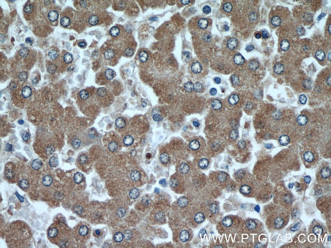 Fetuin-A Antibody in Immunohistochemistry (Paraffin) (IHC (P))