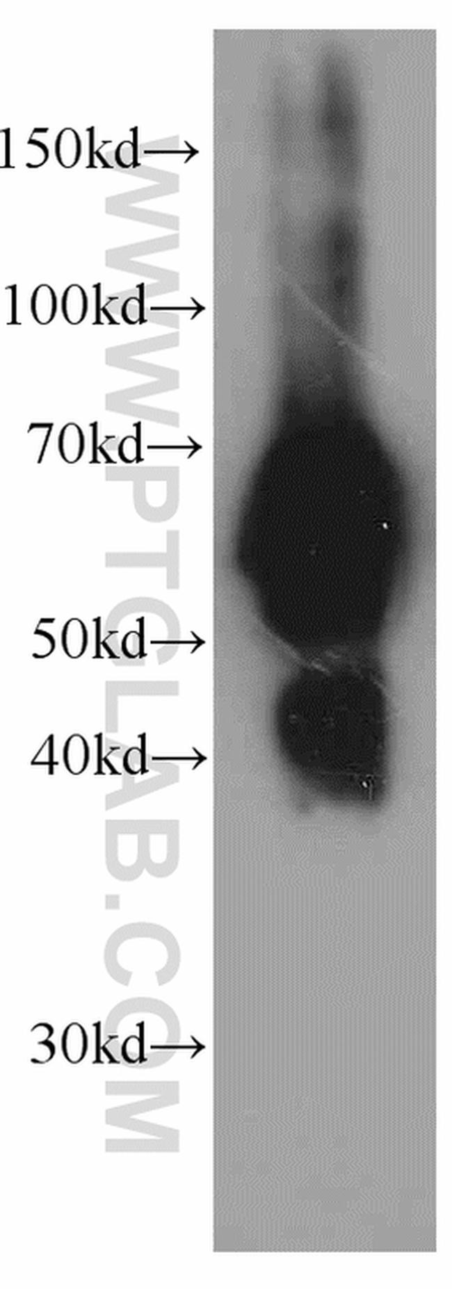 Fetuin-A Antibody in Western Blot (WB)