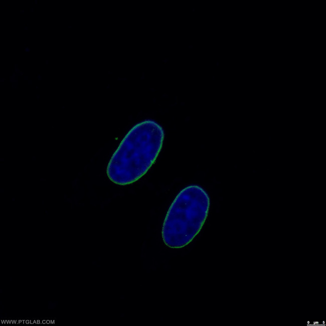 Lamin B1 Antibody in Immunocytochemistry (ICC/IF)