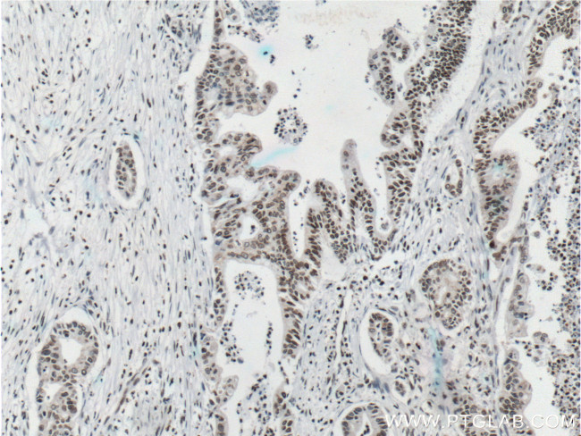 Lamin B1 Antibody in Immunohistochemistry (Paraffin) (IHC (P))