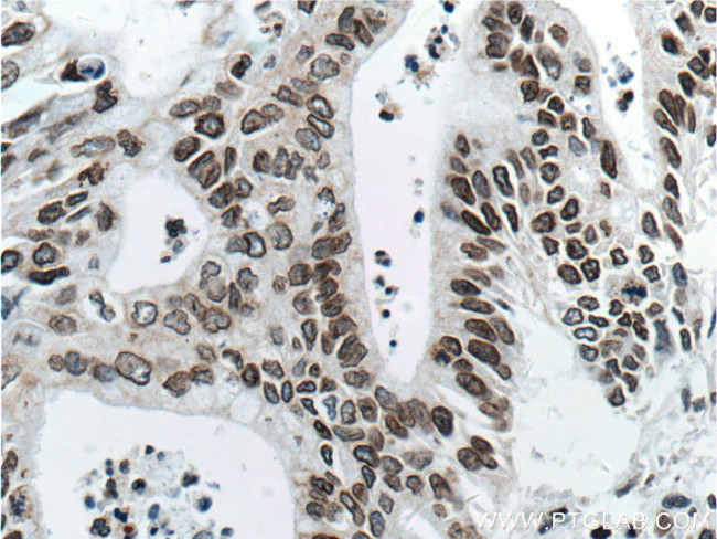 Lamin B1 Antibody in Immunohistochemistry (Paraffin) (IHC (P))