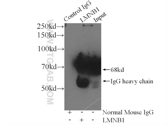 Lamin B1 Antibody in Immunoprecipitation (IP)