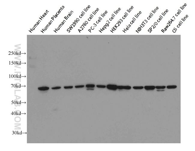 Lamin B1 Antibody in Western Blot (WB)