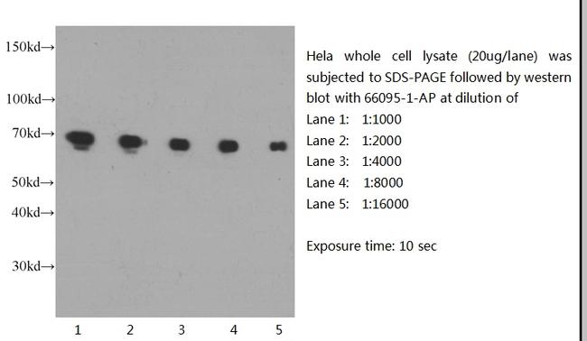 Lamin B1 Antibody in Western Blot (WB)