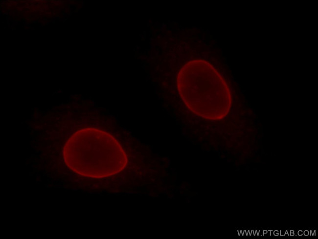 Lamin B1 Antibody in Immunocytochemistry (ICC/IF)