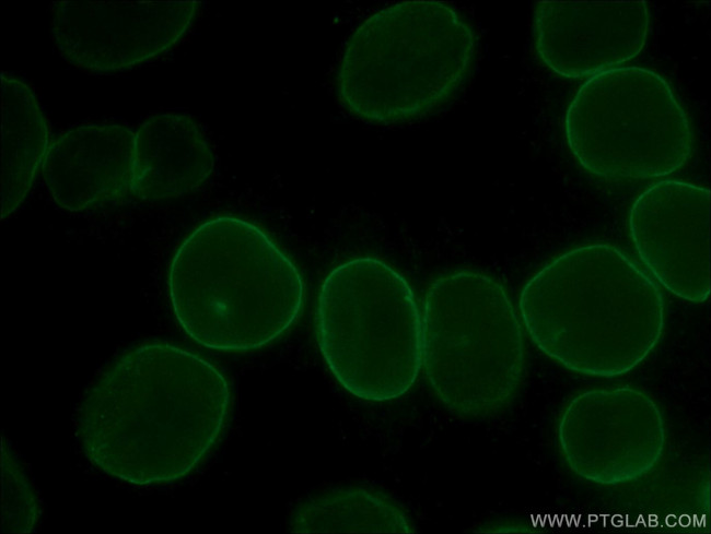 Lamin B1 Antibody in Immunocytochemistry (ICC/IF)