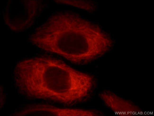 Villin Antibody in Immunocytochemistry (ICC/IF)