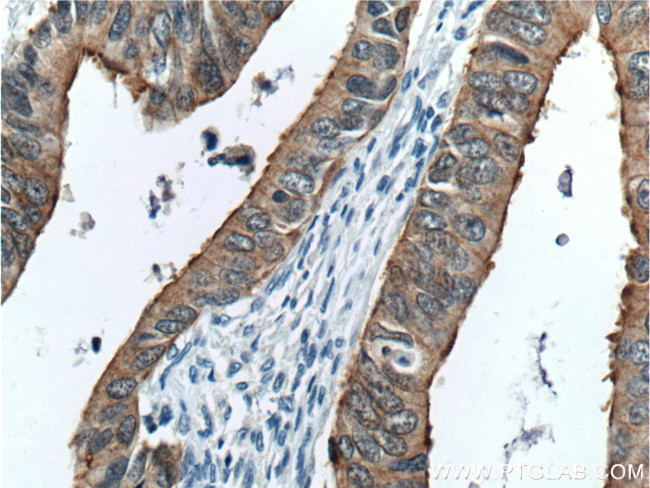 Villin Antibody in Immunohistochemistry (Paraffin) (IHC (P))