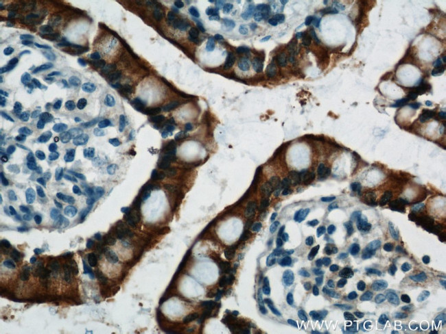 Villin Antibody in Immunohistochemistry (Paraffin) (IHC (P))