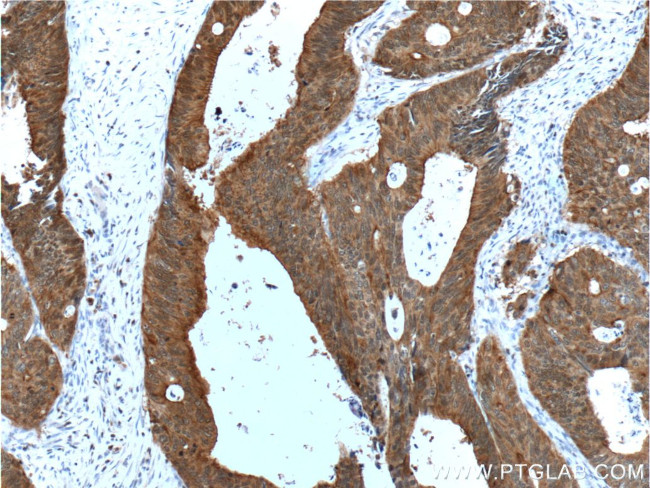 Villin Antibody in Immunohistochemistry (Paraffin) (IHC (P))