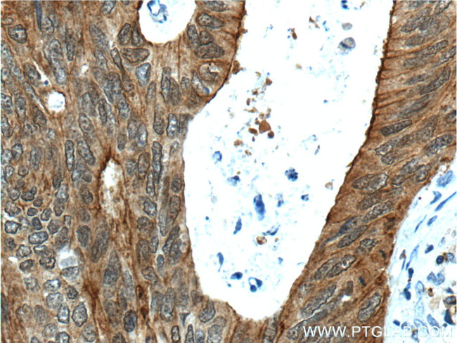 Villin Antibody in Immunohistochemistry (Paraffin) (IHC (P))