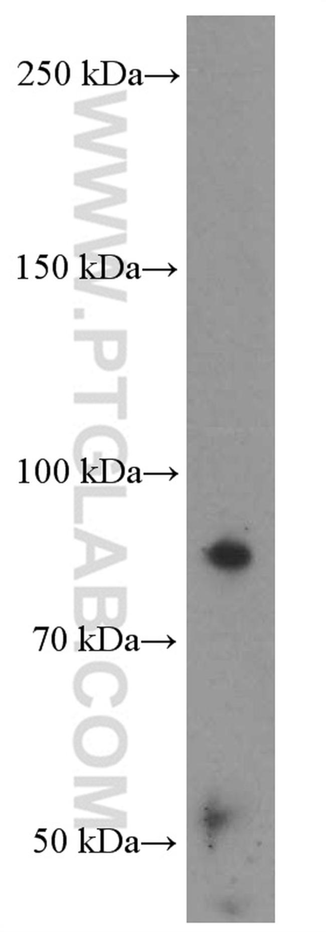 Villin Antibody in Western Blot (WB)