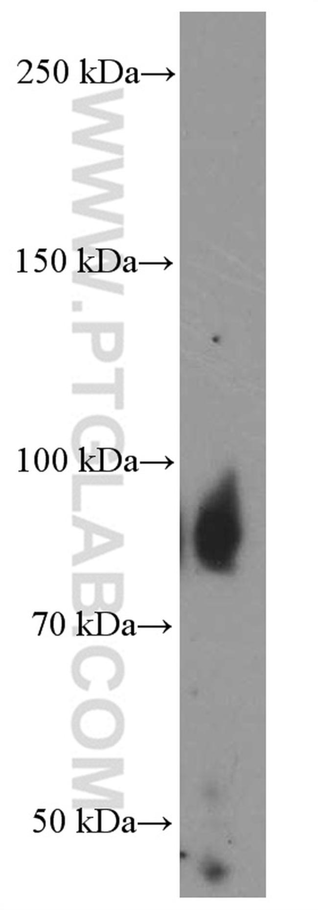 Villin Antibody in Western Blot (WB)