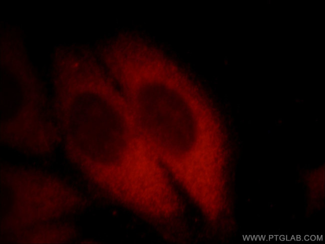 EXOSC2 Antibody in Immunocytochemistry (ICC/IF)