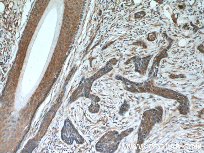 EXOSC2 Antibody in Immunohistochemistry (Paraffin) (IHC (P))