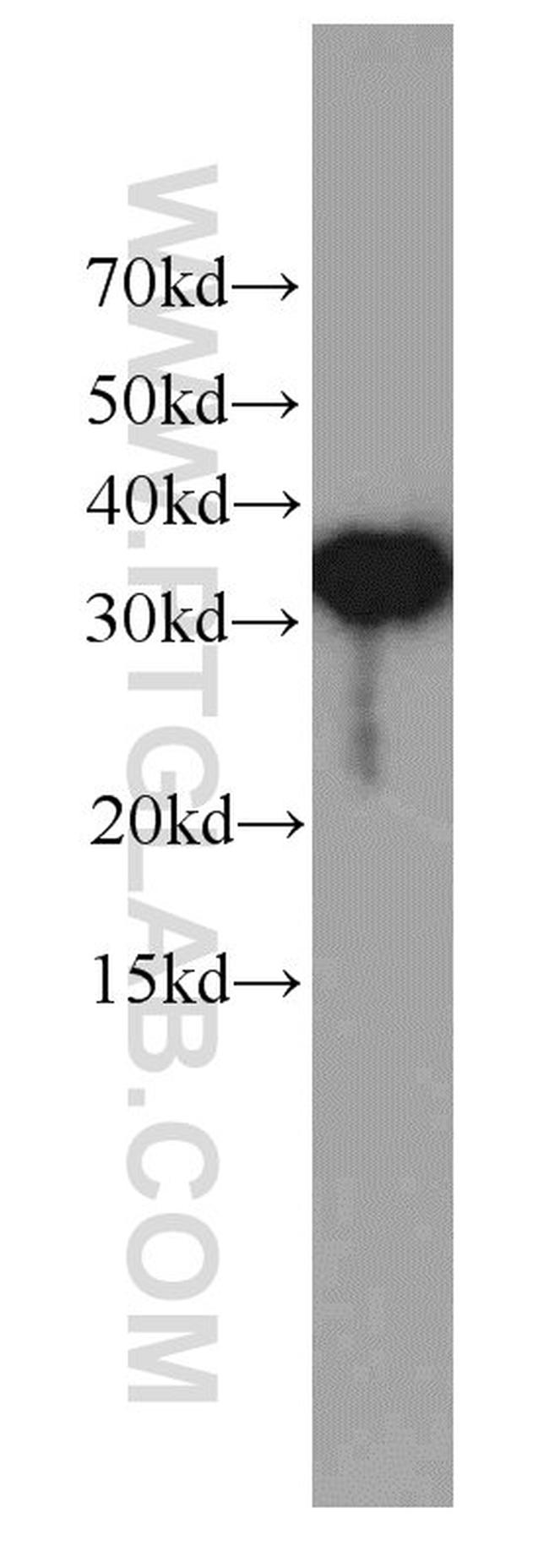 EXOSC2 Antibody in Western Blot (WB)