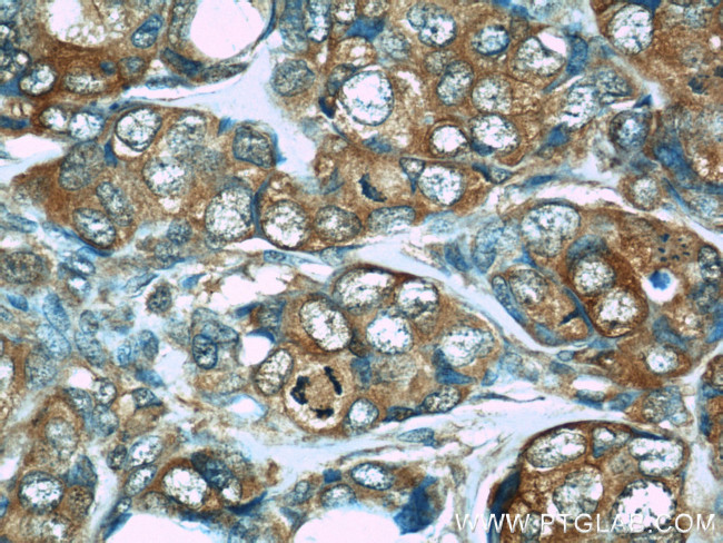 PDCD4 Antibody in Immunohistochemistry (Paraffin) (IHC (P))