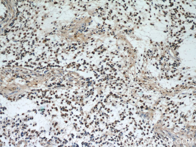 PDCD4 Antibody in Immunohistochemistry (Paraffin) (IHC (P))