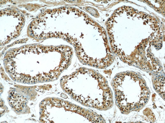 P4HA1 Antibody in Immunohistochemistry (Paraffin) (IHC (P))