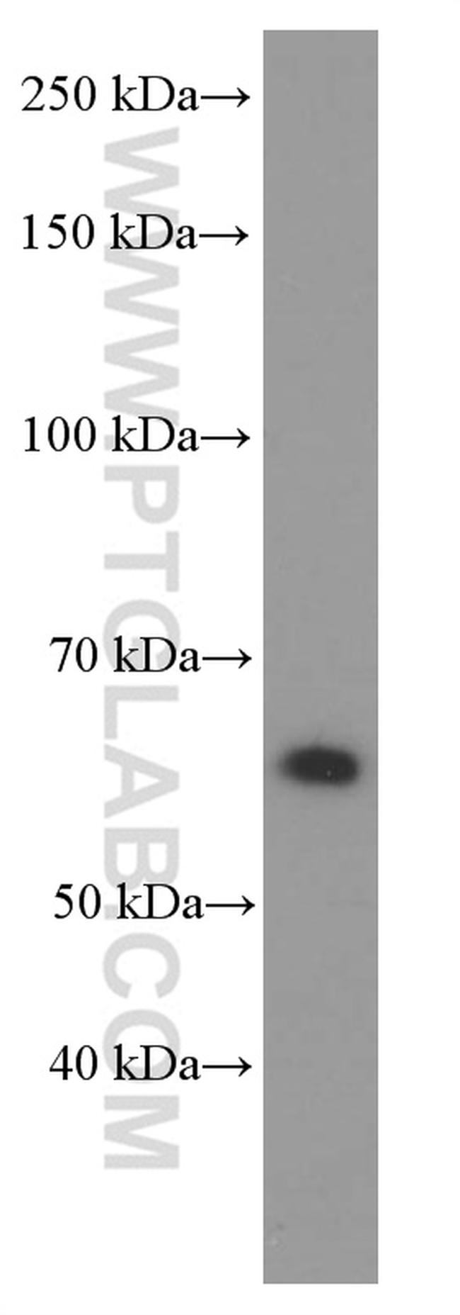 P4HA1 Antibody in Western Blot (WB)