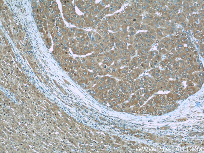 RBP4 Antibody in Immunohistochemistry (Paraffin) (IHC (P))