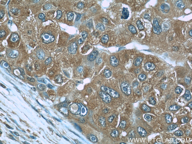 RBP4 Antibody in Immunohistochemistry (Paraffin) (IHC (P))