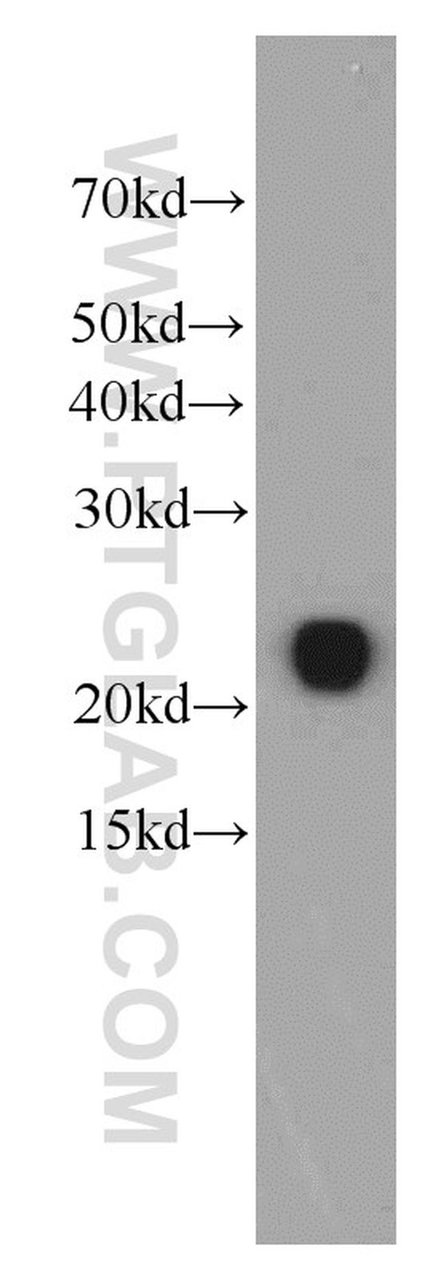 RBP4 Antibody in Western Blot (WB)