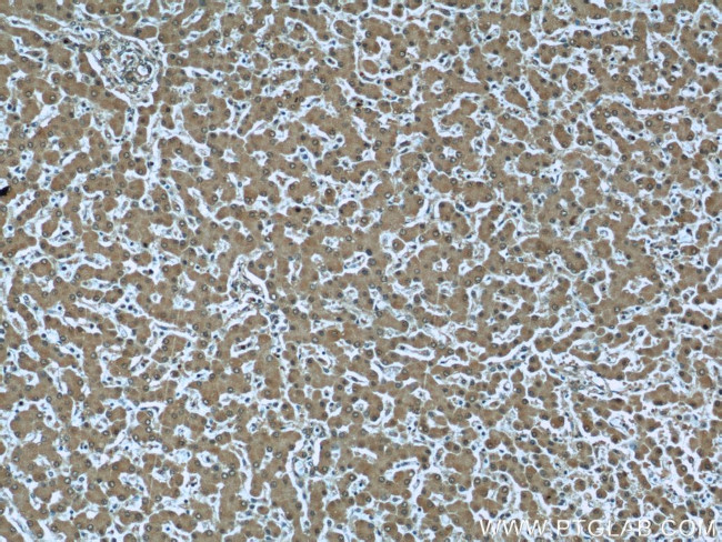 RBP4 Antibody in Immunohistochemistry (Paraffin) (IHC (P))