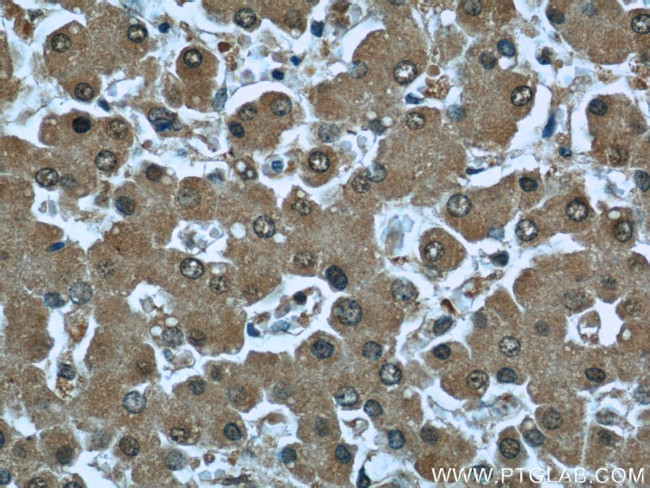 RBP4 Antibody in Immunohistochemistry (Paraffin) (IHC (P))