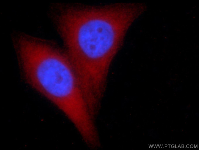 PGM1 Antibody in Immunocytochemistry (ICC/IF)