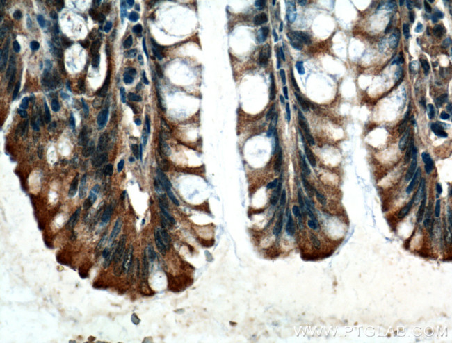 PGM1 Antibody in Immunohistochemistry (Paraffin) (IHC (P))