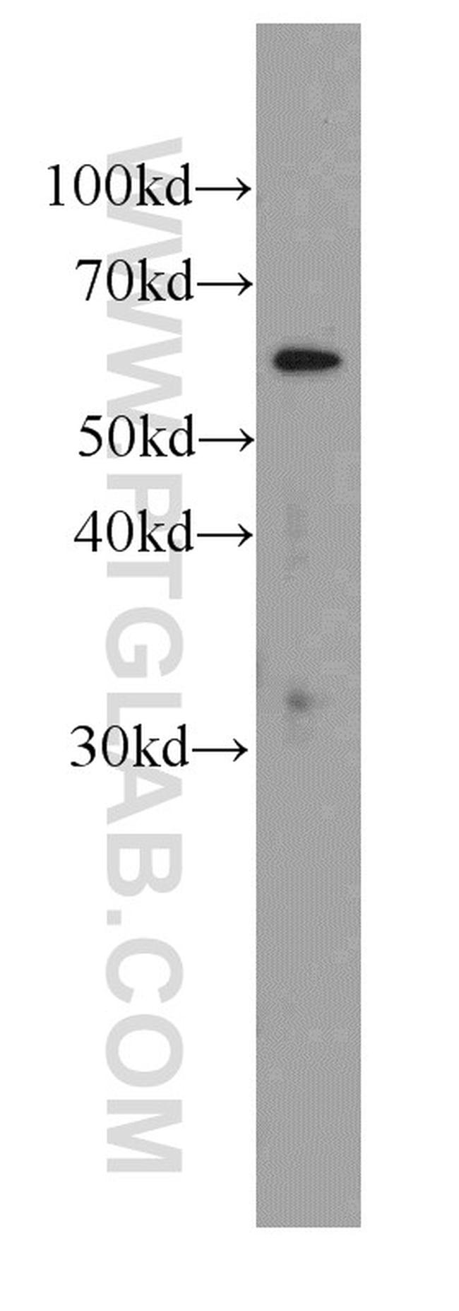 PGM1 Antibody in Western Blot (WB)