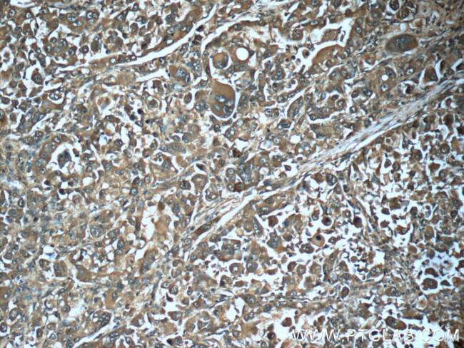 PGM1 Antibody in Immunohistochemistry (Paraffin) (IHC (P))