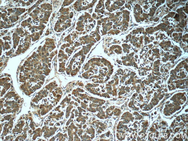 PGM1 Antibody in Immunohistochemistry (Paraffin) (IHC (P))