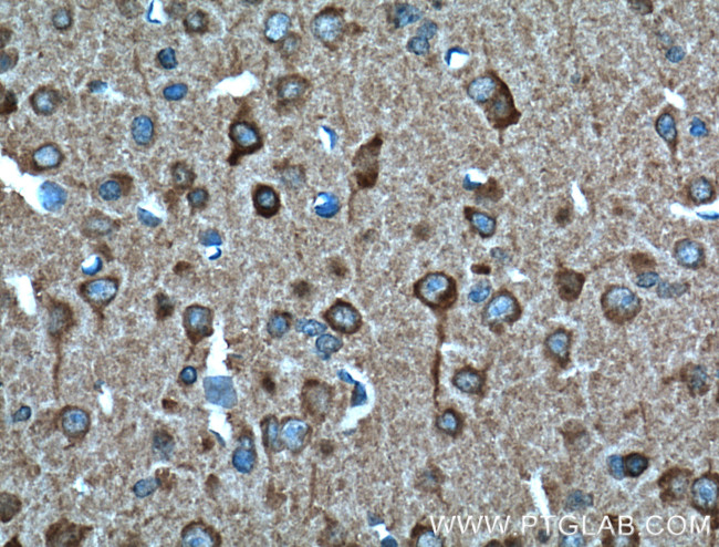 SULT4A1 Antibody in Immunohistochemistry (Paraffin) (IHC (P))