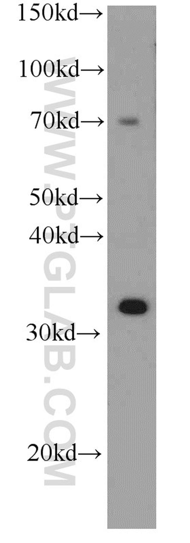 SULT4A1 Antibody in Western Blot (WB)