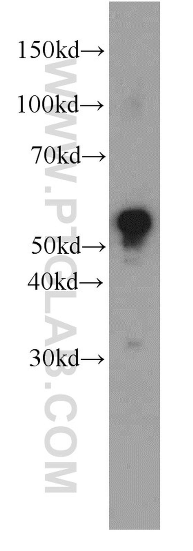 MAOB Antibody in Western Blot (WB)