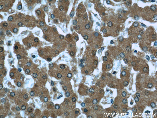 Prealbumin/transthyretin Antibody in Immunohistochemistry (Paraffin) (IHC (P))