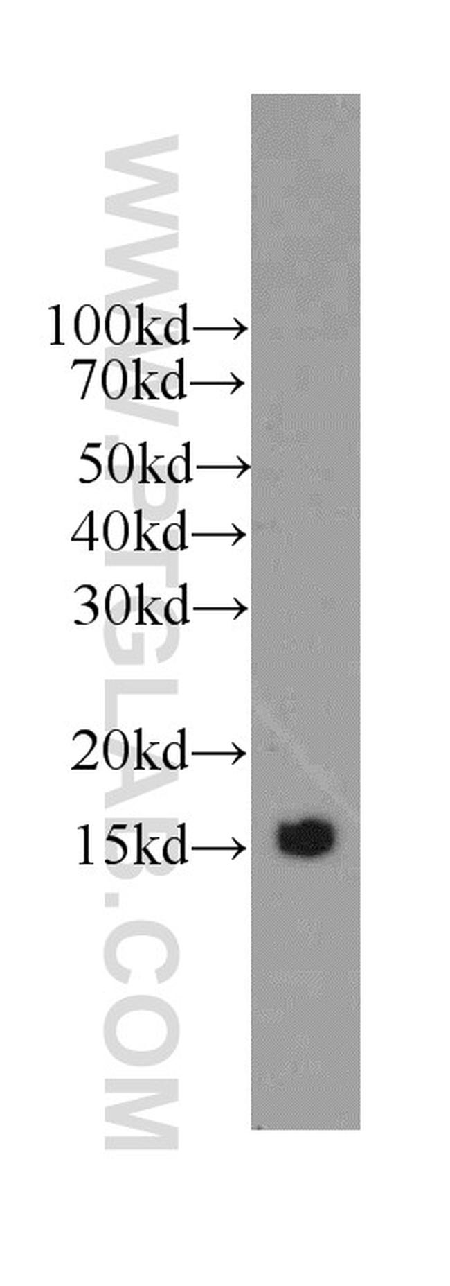 Prealbumin/transthyretin Antibody in Western Blot (WB)