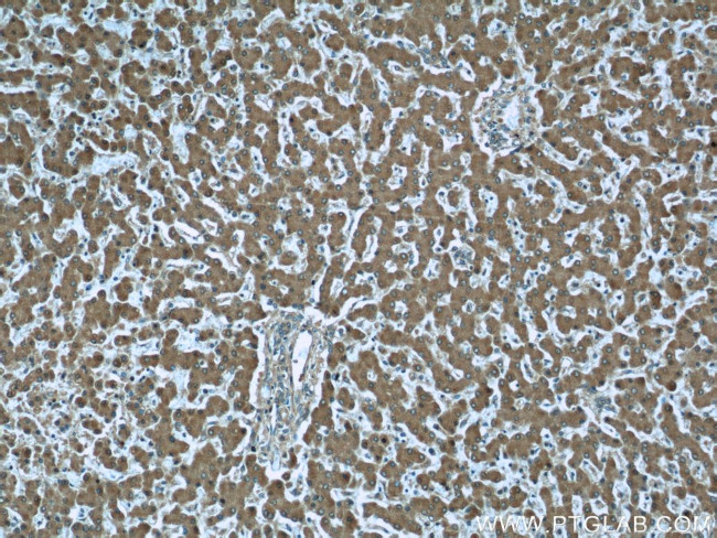 Prealbumin/transthyretin Antibody in Immunohistochemistry (Paraffin) (IHC (P))