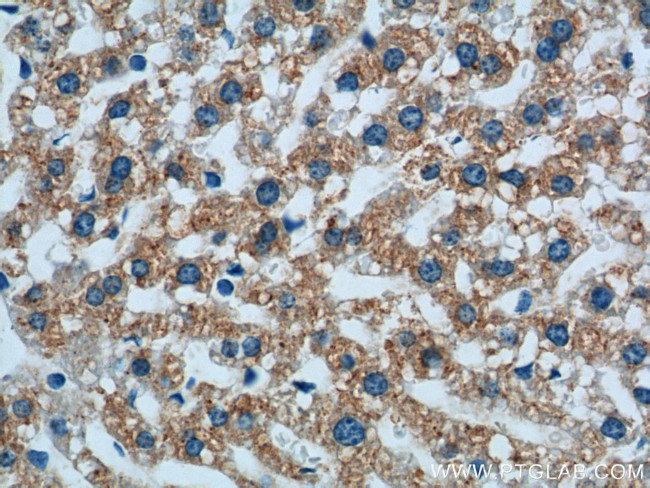 Prealbumin/transthyretin Antibody in Immunohistochemistry (Paraffin) (IHC (P))