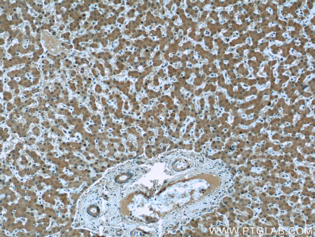 Clusterin Antibody in Immunohistochemistry (Paraffin) (IHC (P))