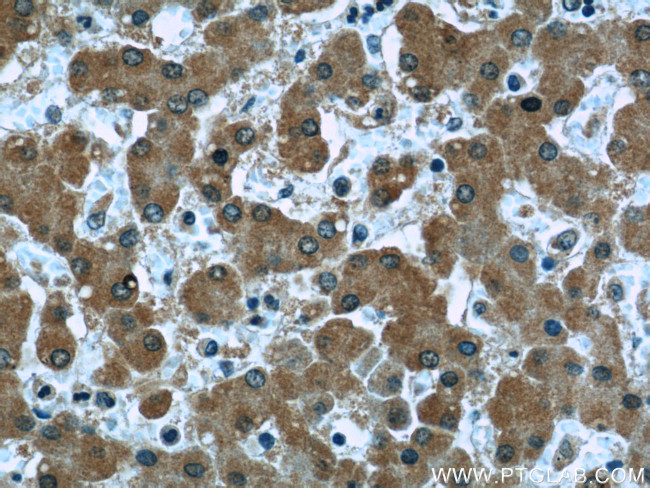 Clusterin Antibody in Immunohistochemistry (Paraffin) (IHC (P))