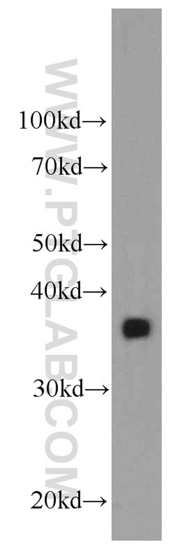 Clusterin Antibody in Western Blot (WB)