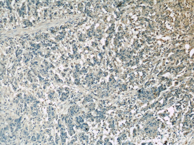 Clusterin Antibody in Immunohistochemistry (Paraffin) (IHC (P))