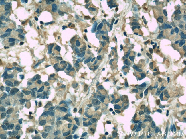 Clusterin Antibody in Immunohistochemistry (Paraffin) (IHC (P))