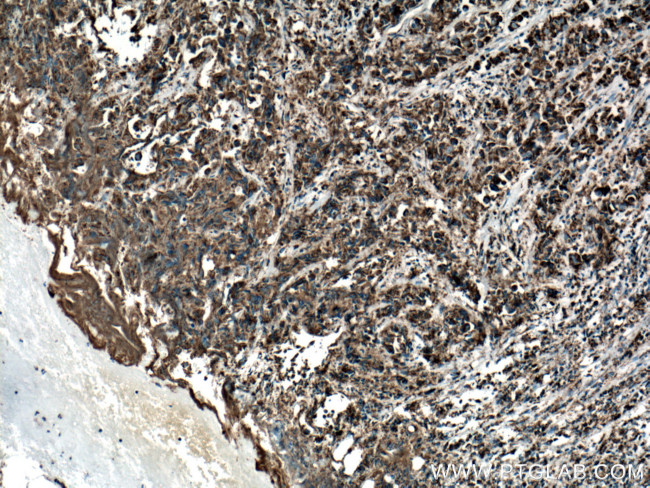 COXIV Antibody in Immunohistochemistry (Paraffin) (IHC (P))