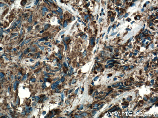 COXIV Antibody in Immunohistochemistry (Paraffin) (IHC (P))