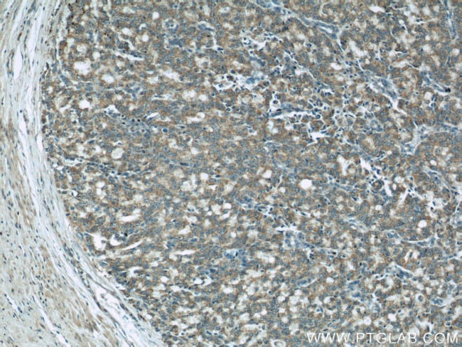 COXIV Antibody in Immunohistochemistry (Paraffin) (IHC (P))